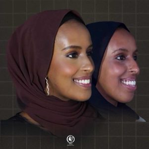 Before and after bimaxillary orthognathic surgery showing improved facial symmetry
